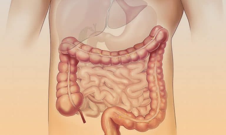 Crohn’s And Marijuana: THC Can Ease Painful Symptoms