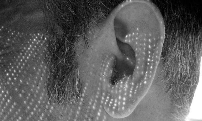 How Marijuana Can Help Tinnitus And Neuronal Hyperactivity