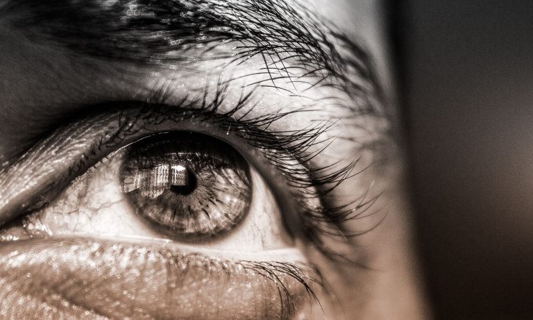 What The Heck Is Trichotillomania And Can Cannabis Help?