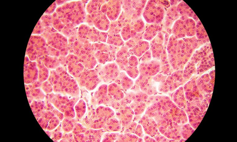 What You Should Know About Medical Marijuana And Pancreatitis