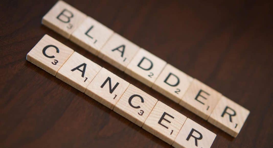 bladder cancer