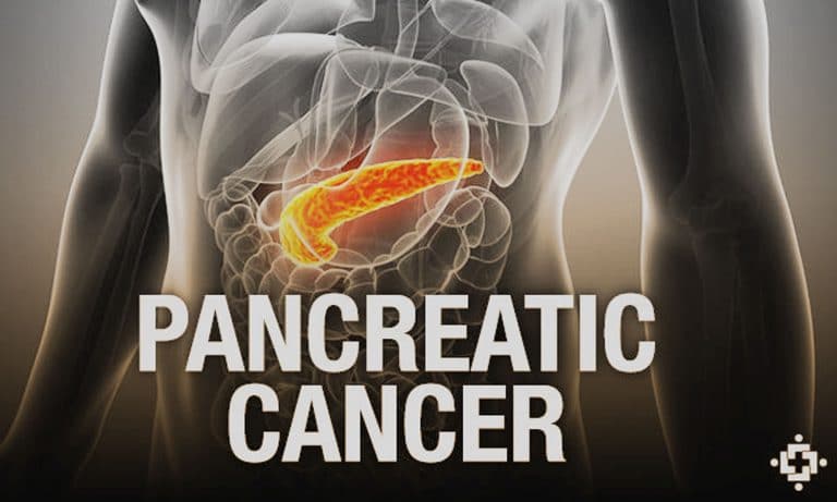 Pancreatic Cancer: What Role Does Marijuana Play In Treatment?