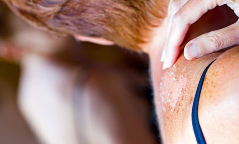 Can Medical Marijuana Treat And Cure Skin Cancer?