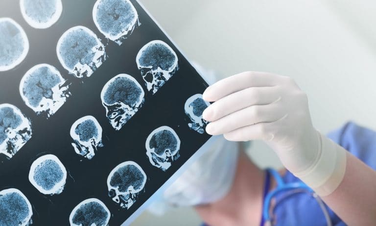 Big Pharma Green Lights Cannabis-Based Drug For Epilepsy