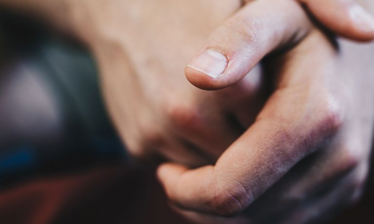 How Cannabis Can Help Those Who Suffer With Psoriasis