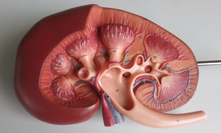 Marijuana Cannabinoids And Kidney Disease