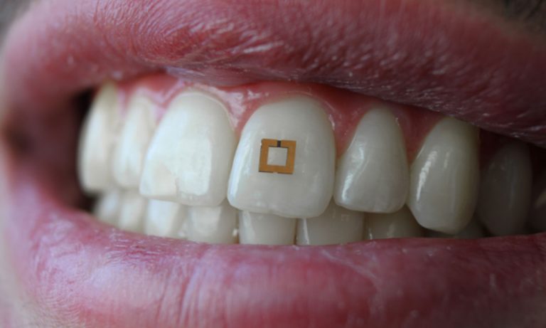 This ‘Smart Tooth’ Can Track Everything You Eat