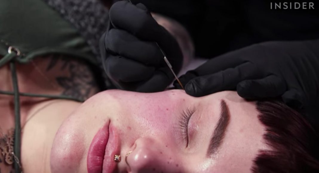 WATCH: People Are Getting Fake Freckles Tattooed On Their Face