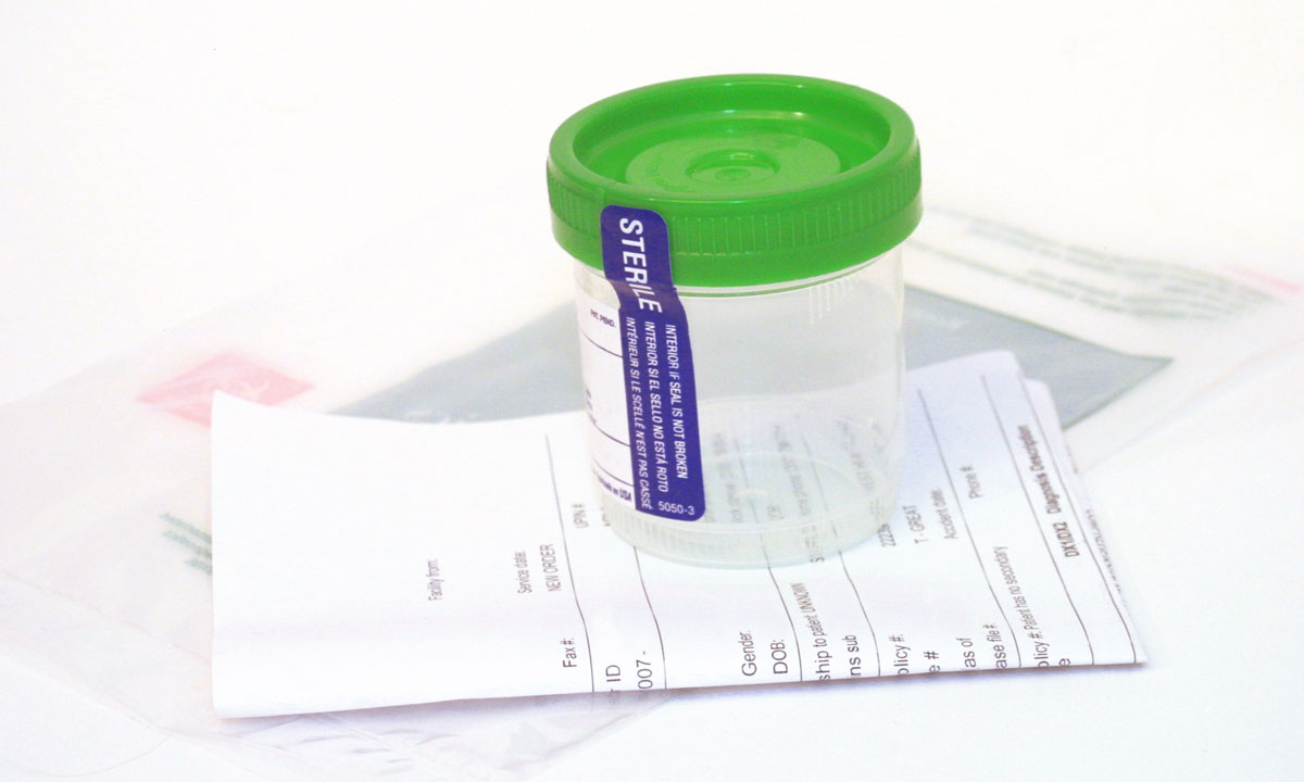 Random drug testing procedure image