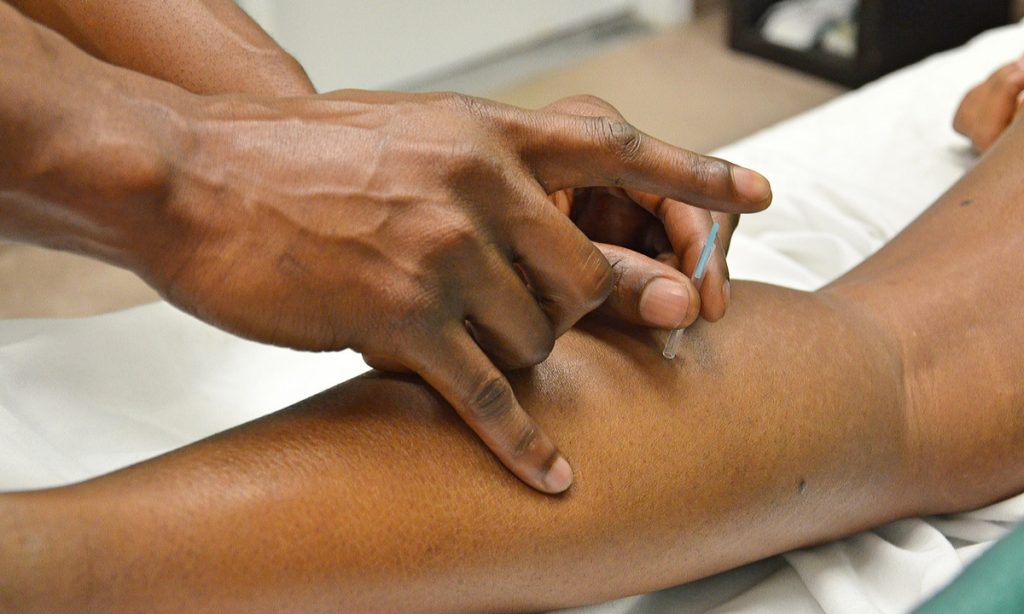 What can you expect from your first acupuncture appointment?