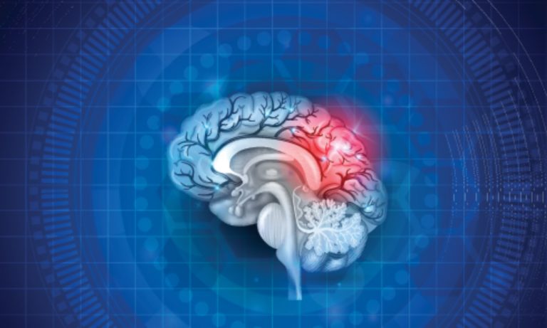 Cannabis: Optimal Treatment Method For Post-Concussion Syndrome Symptoms