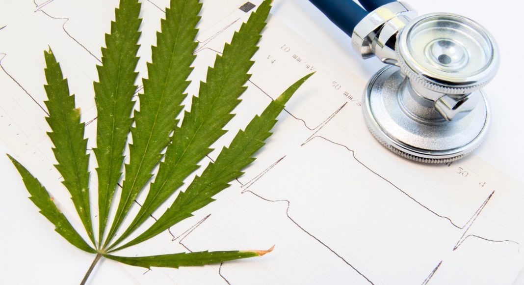 disclosing marijuana use before surgery what you nee to know