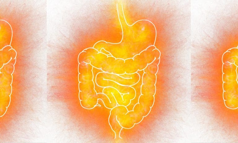 Does Cannabis Boost Your Gut Bacteria