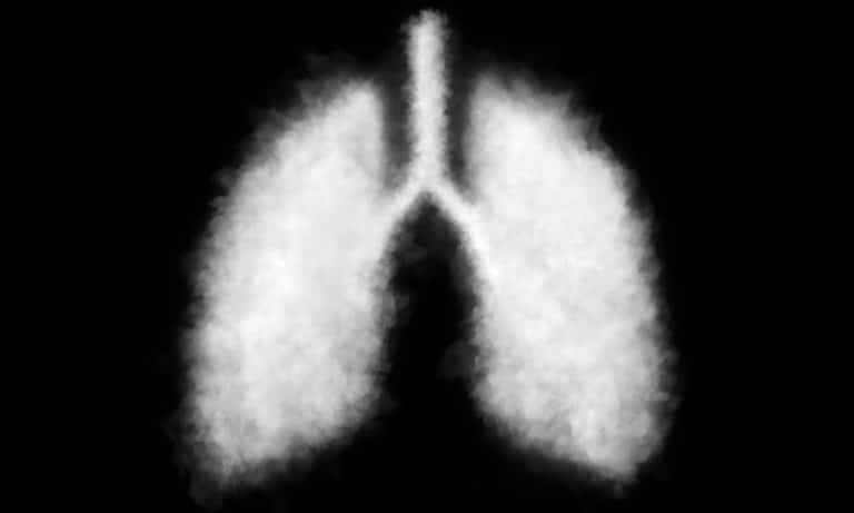 Lowest Rate Of Vape Lung Injury In Legal Weed States
