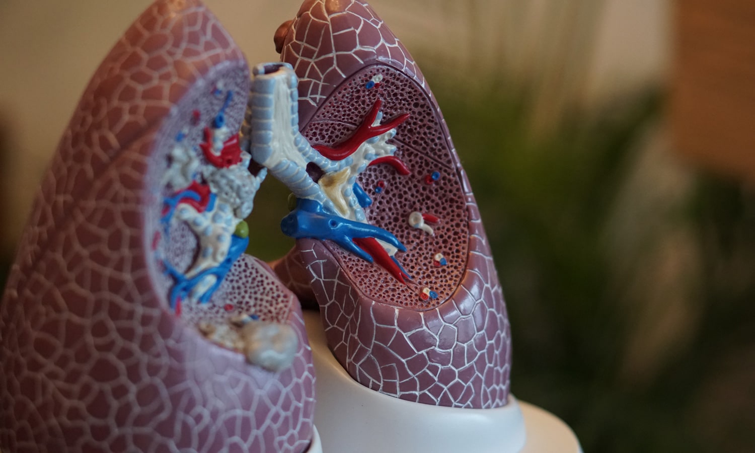 What Lung Experts Say About Coronavirus Risk To Marijuana Smokers