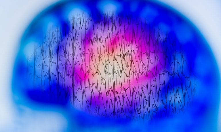 14-Year-Old Epilepsy Patient Is Seizure Free After Two Years Of Medical Cannabis Treatment