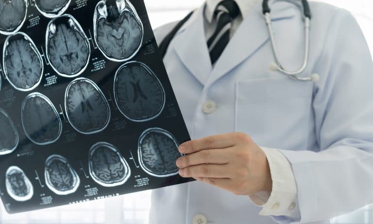 Cannabis-Based Sativex Mouth Spray To Treat Brain Tumors?