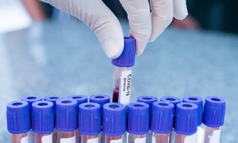 FDA Authorizes Next Generation Test For Diagnosing COVID-19