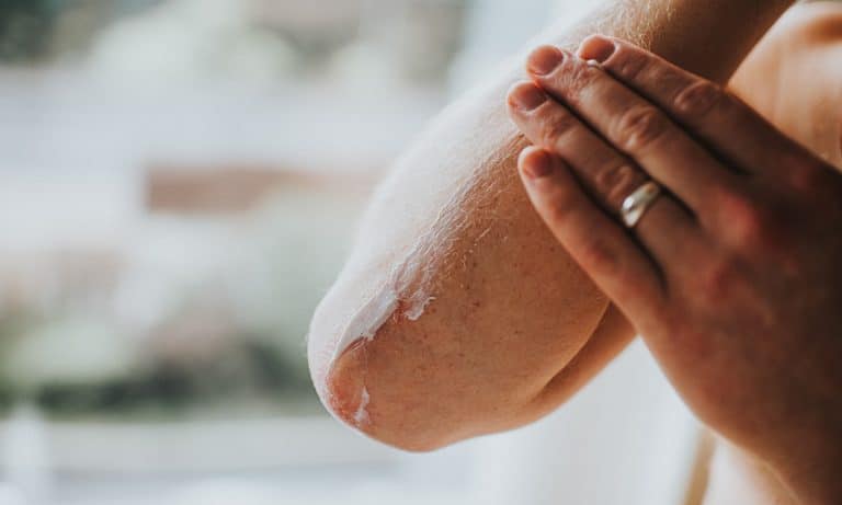Is CBD Oil A Potential Psoriasis Treatment
