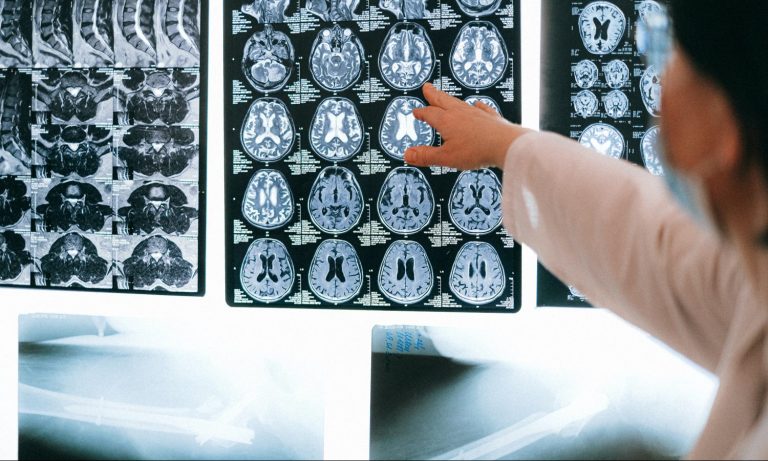 Losing Inhibition After Brain Trauma—What You Need To Know