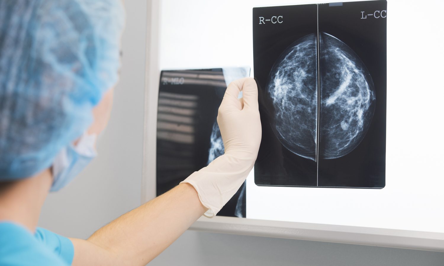 The COVID-19 Vaccine Might Be Messing With Your Mammogram