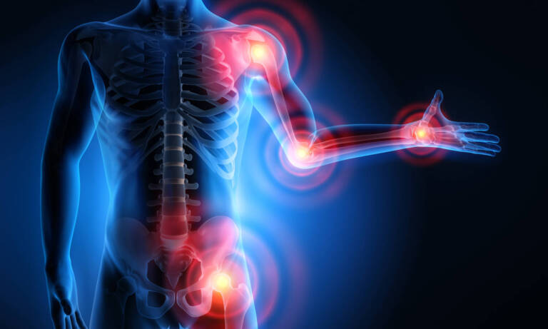 Cannabis And Inflammation, What’s The Connection?