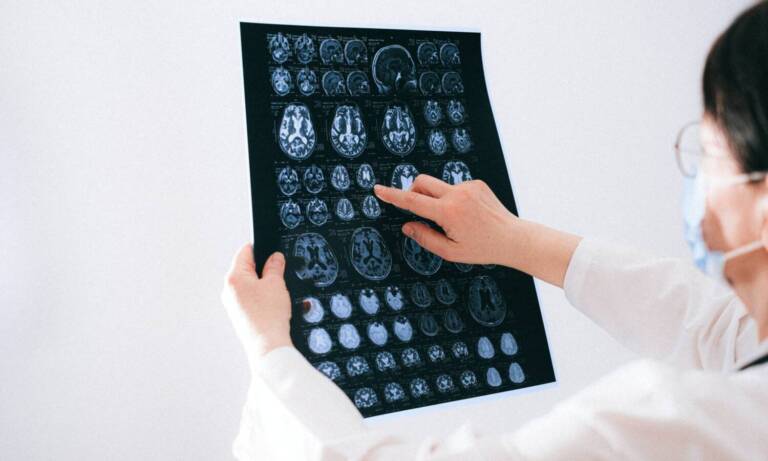 DEA Delays Production Of Marijuana Drug As Potential Treatment For MS And Huntington’s Disease