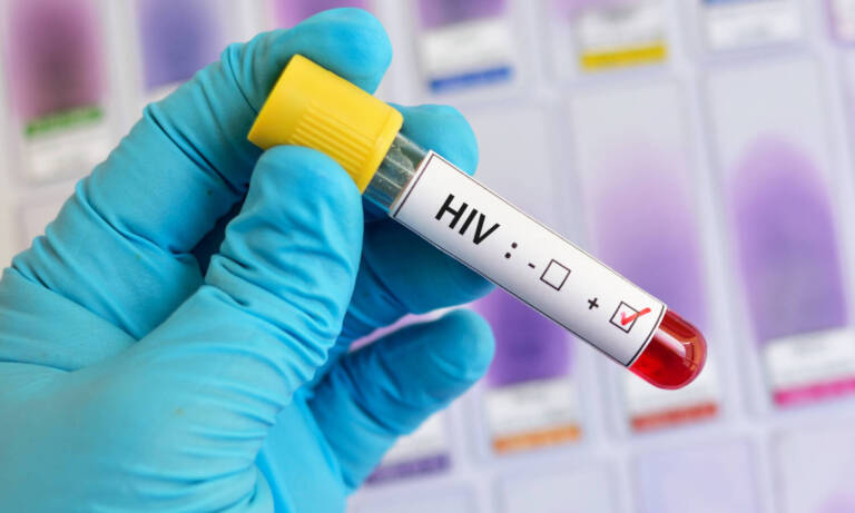 Cannabis And HIV: Where Do We Stand With Research?