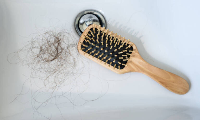 Can Cannabis Help Treat Alopecia?