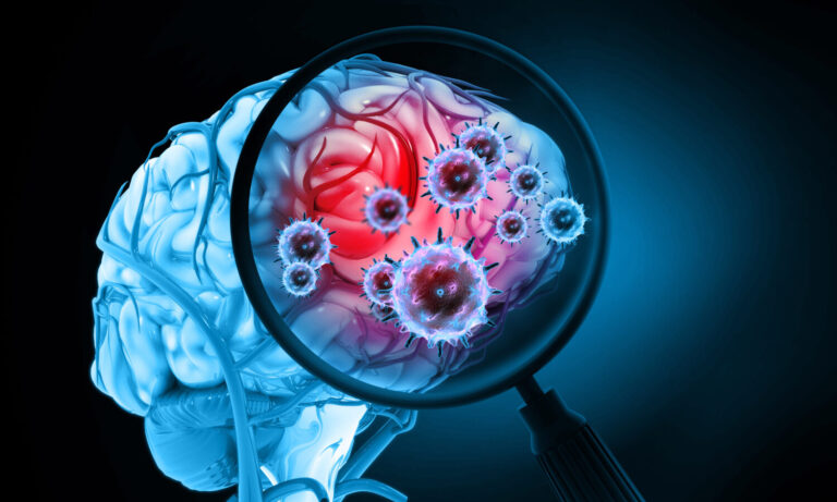 Does Medical Cannabis Work For Meningitis?