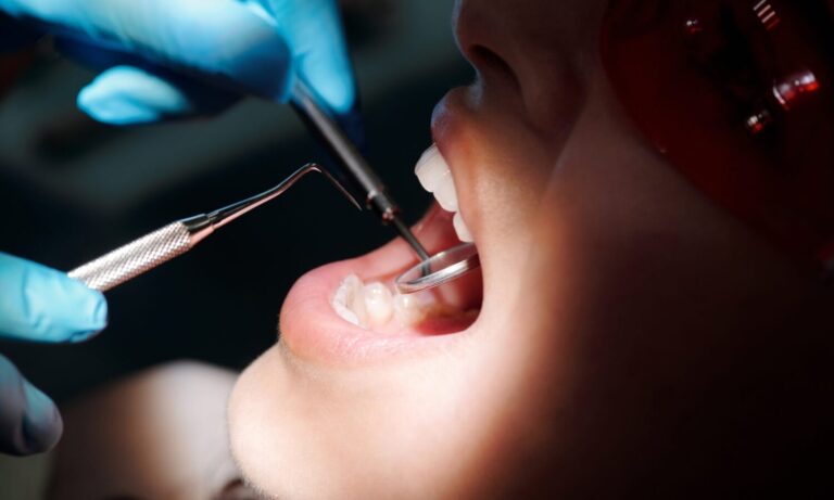 How Smoking Marijuana Affects Oral Health