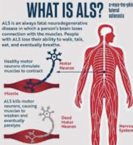 The Latest On Medical Cannabis and ALS